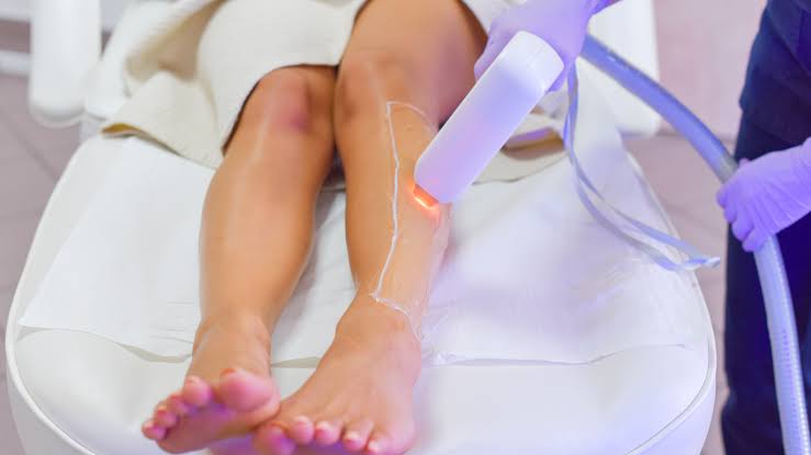 1300w Advanced Laser Hair Removal Machine